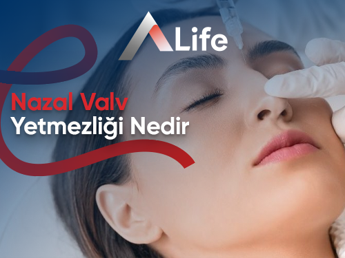 Nazal Valv Yetmezliği Nedir?
